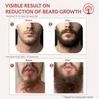 Ivory Natural Beard Growth Serum For Beard Wellness | Grocsy