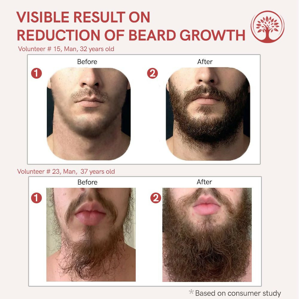 Ivory Natural Beard Growth Serum For Beard Wellness | Grocsy