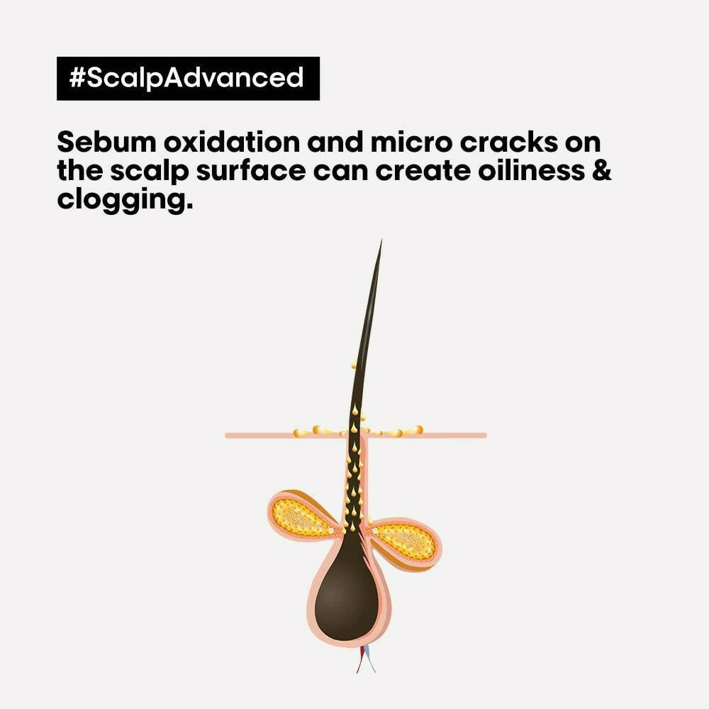 L'Oreal Paris Professionnel Scalp Advanced Anti-Oiliness Dermo-Purifier Shampoo Absolut Repair Professional Hair Mask | Grocsy