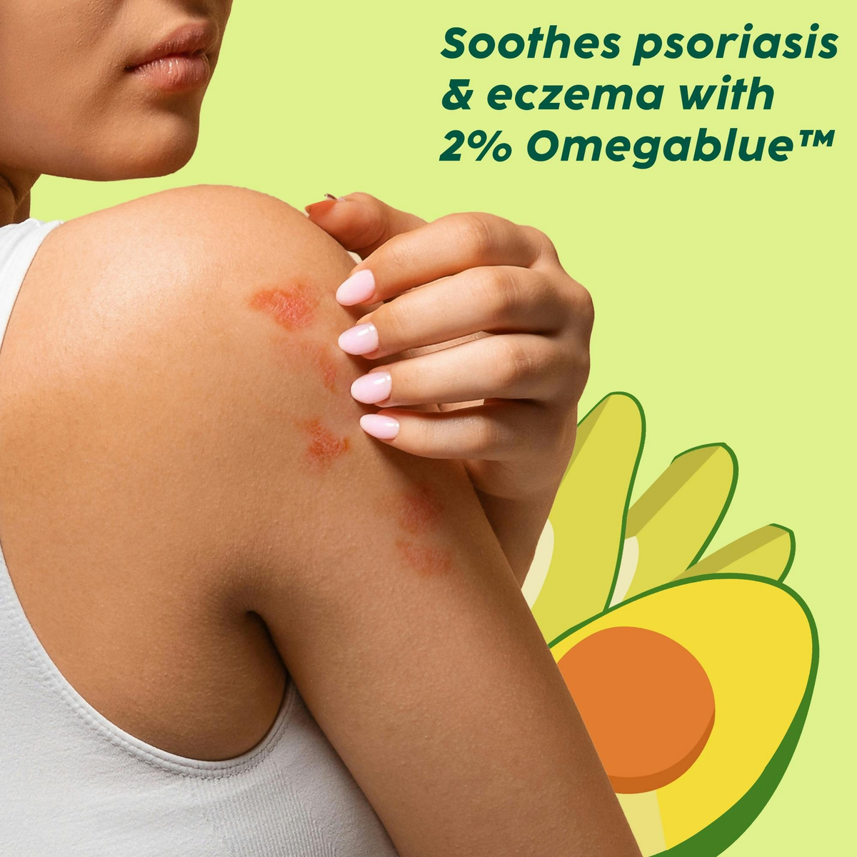PLIX The Plant Fix Avocado Psoriasis Moisturizing Cream with 2% Omegablue For Dry & Flaky Skin | Grocsy