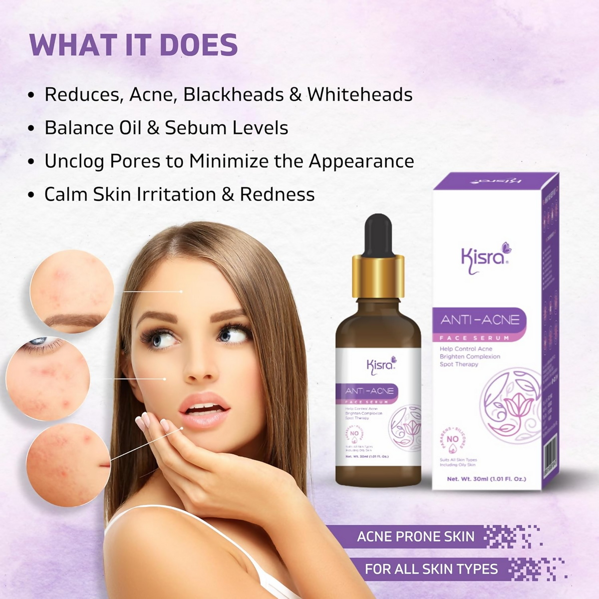 Kisra Anti-Acne Face Serum for Acne | Grocsy