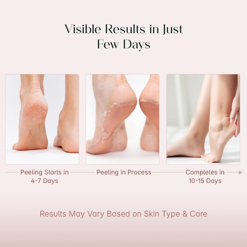 Seoulskin Glycolic Acid Foot Peeling Mask | Grocsy
