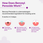 The Derma Co 2.5% Benzoyl Peroxide Spot Corrector | Grocsy