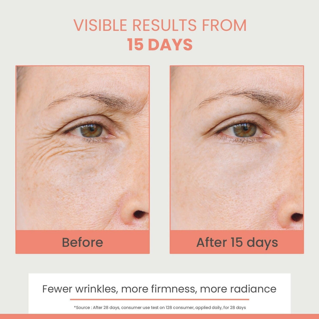 Avene Hyaluron Activ B3 Concentrated Plumping Serum | Grocsy