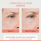 Avene Hyaluron Activ B3 Concentrated Plumping Serum | Grocsy