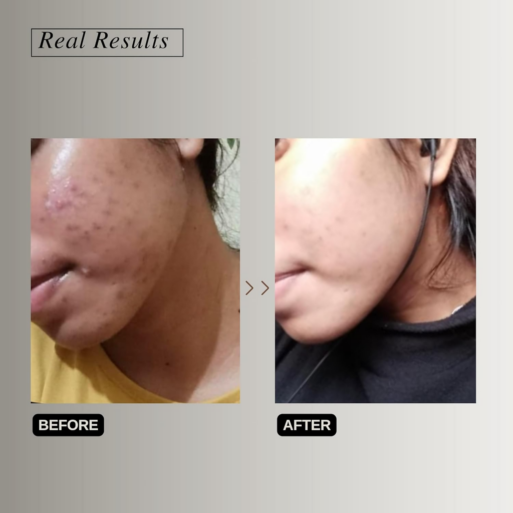 The Formularx Vitamin C Brightening Serum With Arbutin & Nag For Glowing Skin | Grocsy