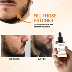 Nourish Mantra Advanced Beard Growth Oil Serum with Redensyl | Grocsy