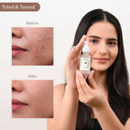 Dromen & Co Niacinamide Serum - Fights acne & blemishes Tighten Pores | Grocsy