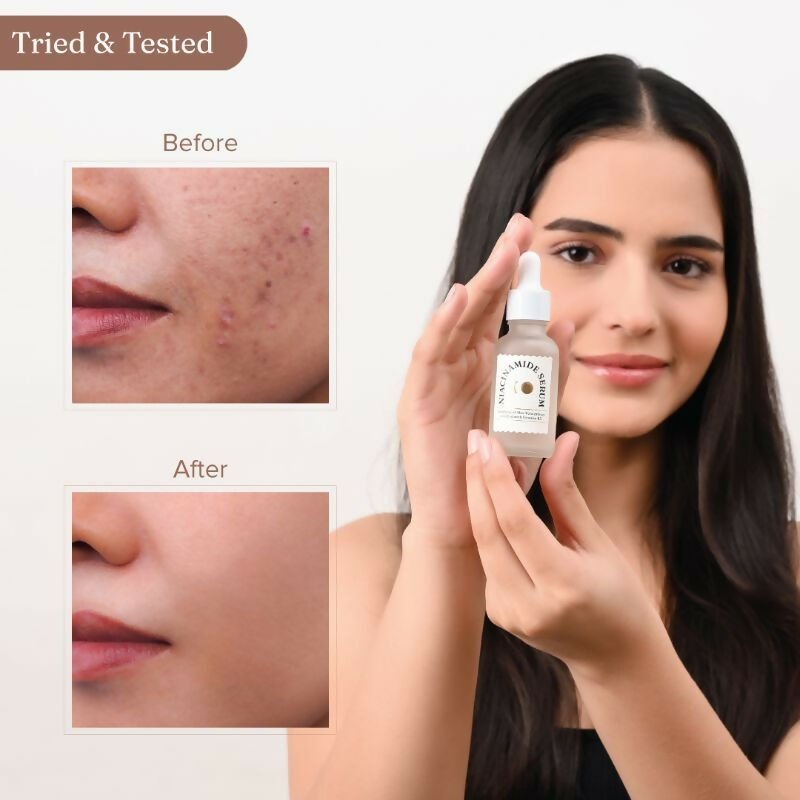 Dromen & Co Niacinamide Serum - Fights acne & blemishes Tighten Pores | Grocsy