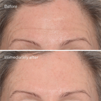 Murad Targeted Wrinkle Corrector | Grocsy