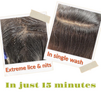 Botanical Luxuriate Tea Tree Anti Lice and Nits Shampoo | Grocsy