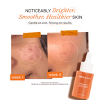 Bayla Skin Peach & 2% Alpha Arbutin Triple-Action Face Serum | Grocsy