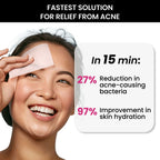ThriveCo Goodbye Acne Kit | Grocsy