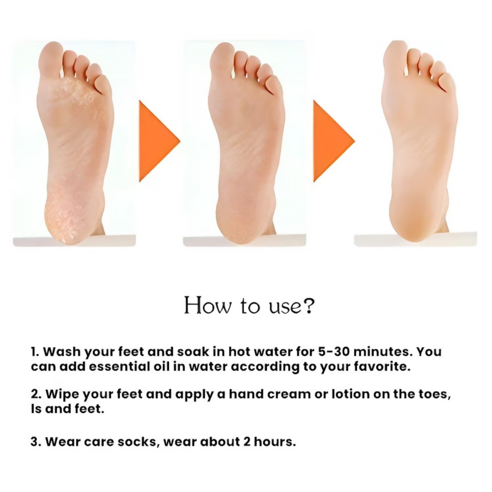 Bronson Professional Smiling Foot Anti Crack Silicone Socks | Grocsy