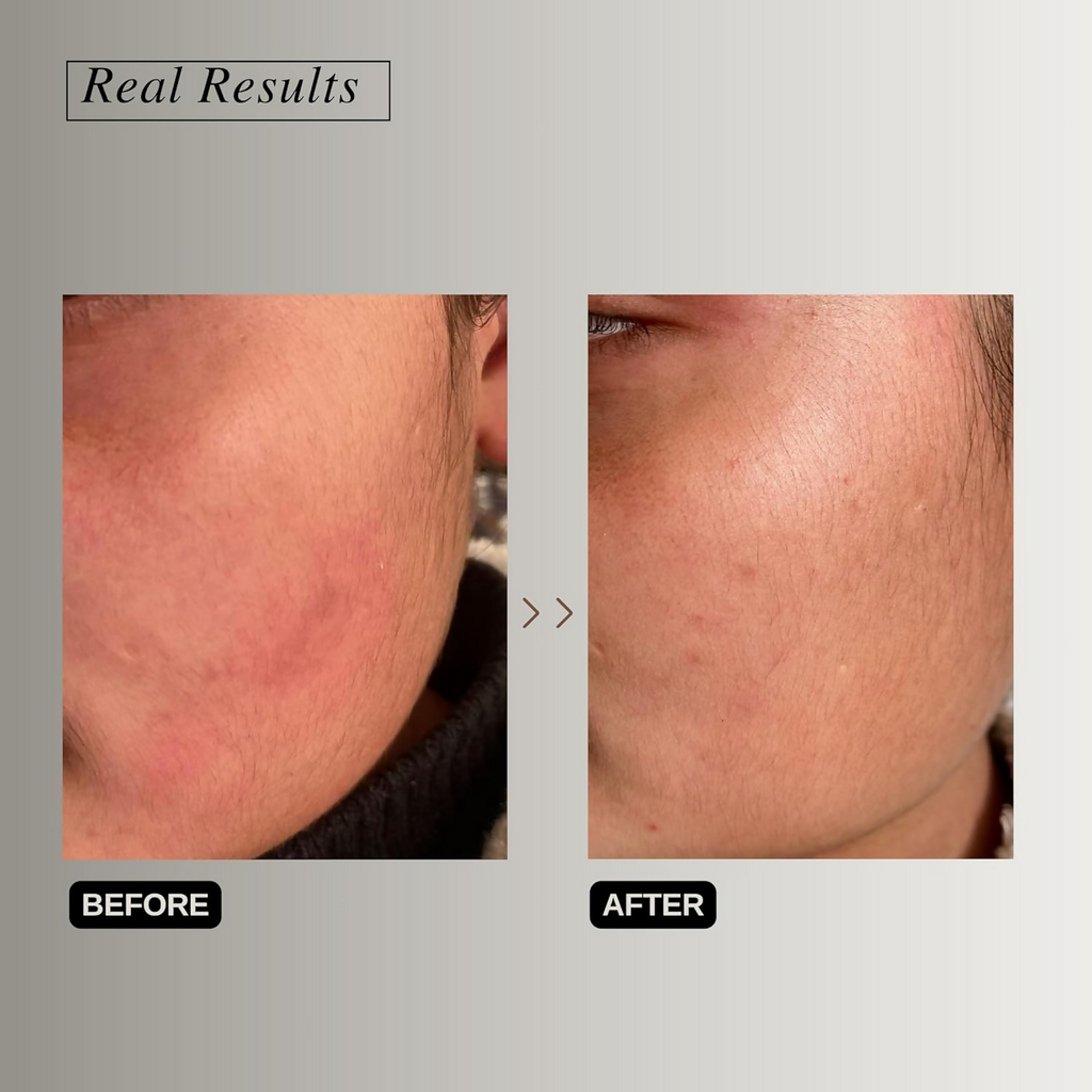 The Formularx Peptide Ceramide Moisturizer - Barrier Plus | Grocsy