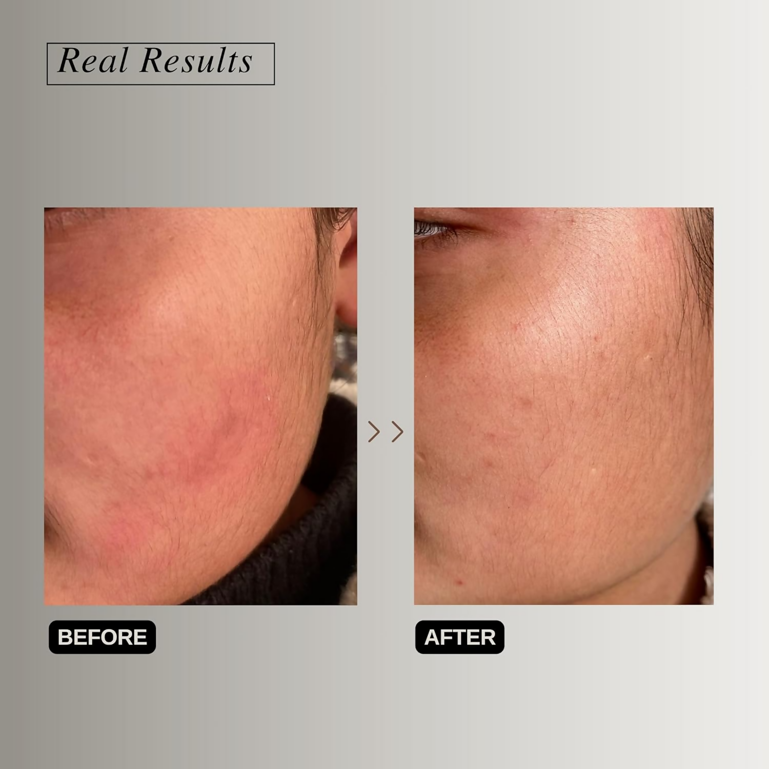 The Formularx Peptide Ceramide Moisturizer - Barrier Plus | Grocsy