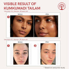 Ivory Natural Kumkumadi Tailam Face Oil - Saffron And Lotus Essence For Skin Revitalization | Grocsy