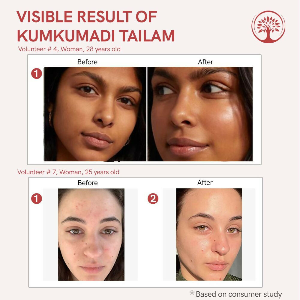 Ivory Natural Kumkumadi Tailam Face Oil - Saffron And Lotus Essence For Skin Revitalization | Grocsy