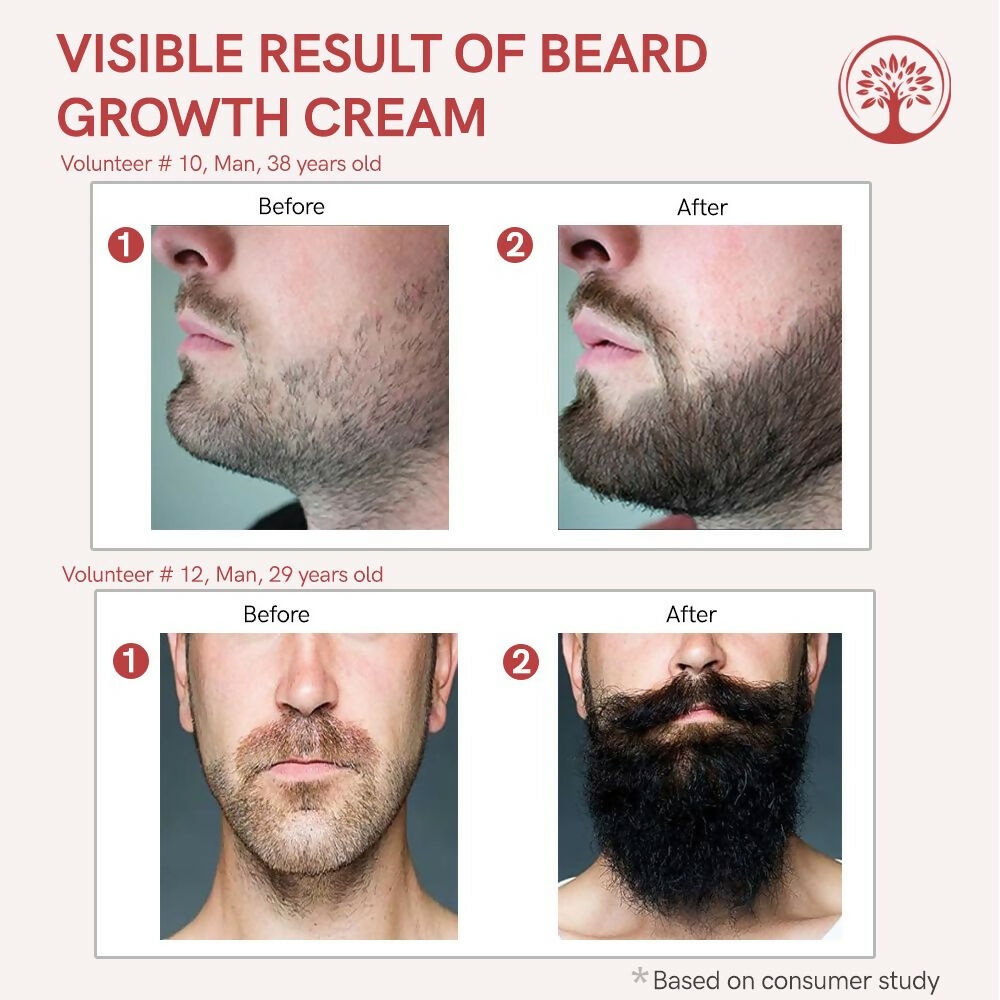Ivory Natural Beard Growth Cream - Biotin Boosted Hair Follicle For New Hair Cycle | Grocsy