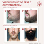Ivory Natural Beard Growth Cream - Biotin Boosted Hair Follicle For New Hair Cycle | Grocsy