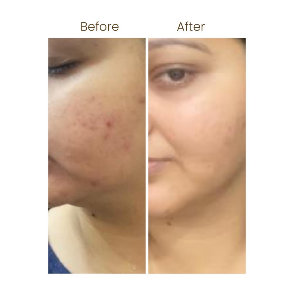 Personal Touch Aquarize Toner + Mist With Hyaluranic Acid For Intense Hydration All Skin Type | Grocsy