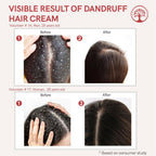 Ivory Natural Dandruff Hair Cream For Dandruff, And Nourishing Dry Scalp | Grocsy