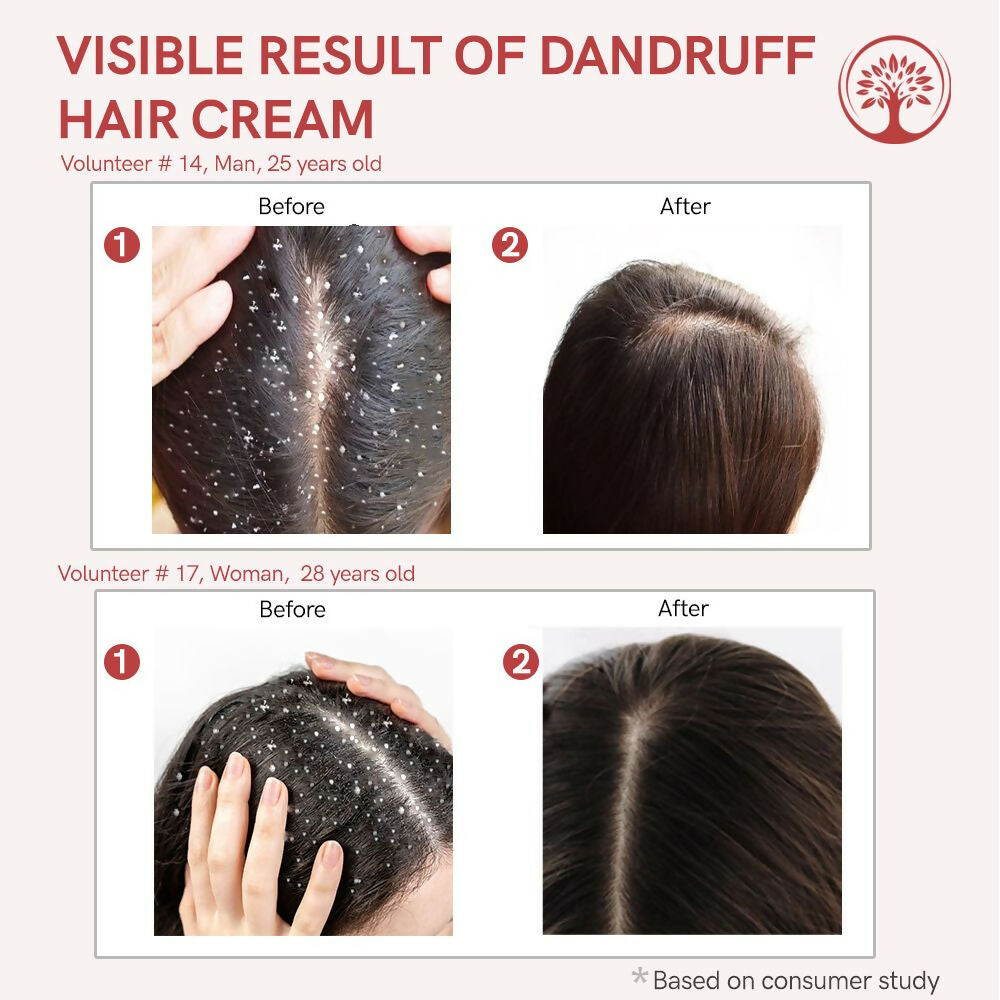 Ivory Natural Dandruff Hair Cream For Dandruff, And Nourishing Dry Scalp | Grocsy