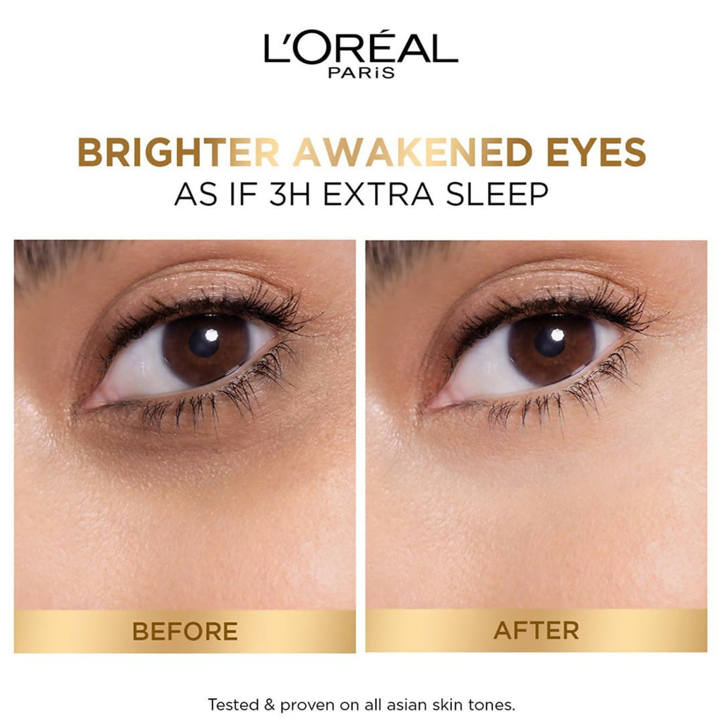 L'Oreal Paris Glycolic Bright Dark Circle Eye Serum With 3% [Glycolic + Vit Cg + Niacinamide] | Grocsy