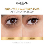 L'Oreal Paris Glycolic Bright Dark Circle Eye Serum With 3% [Glycolic + Vit Cg + Niacinamide] | Grocsy