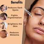 Dermistry Skin Perfecting Fairness Face Serum Resorcinol Kojic Acid Hyper Pigmentation Uneven Tone | Grocsy