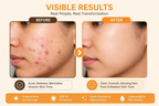 Milky Moon Ginseng Glow Face Wash | Grocsy