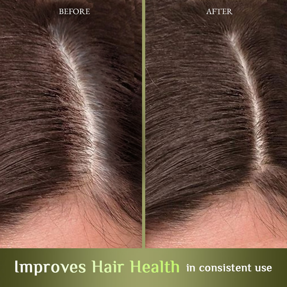 Richfeel Hair Nourisher Oil - Hair Fall Control & Growth Treatment | Grocsy