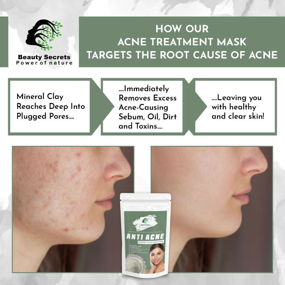 Beauty Secrets Anti Acne Face Mask | Grocsy