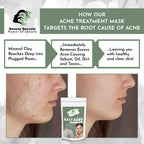 Beauty Secrets Anti Acne Face Mask | Grocsy