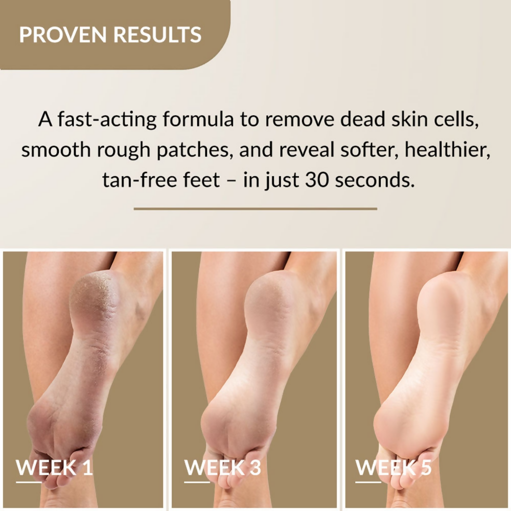 Fixderma Foobetik Foot Scrub Spray | Grocsy