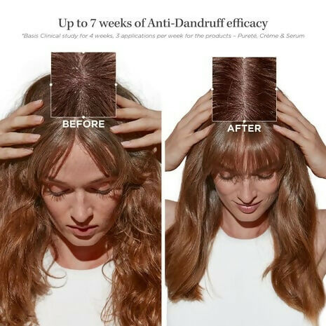 Kerastase Symbiose Bain Pureté Anti-Dandruff Shampoo | Grocsy