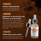 Man Matters Clear Face Serum for Men With Niacinamide & Zinc | Grocsy