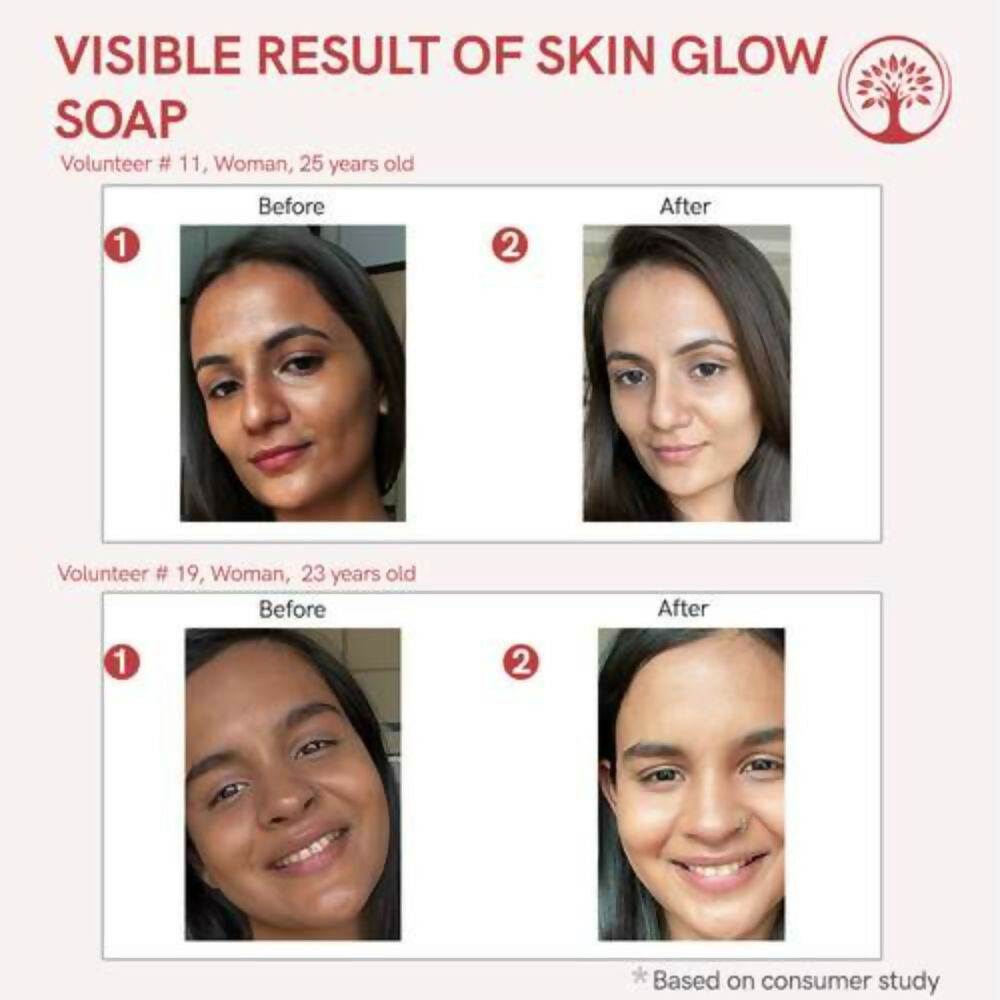 Ivory Natural Skin Glow Soap - Revitalizes, Moisturizes, And Natural Radiance | Grocsy