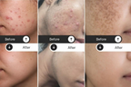 Milky Moon Kumkumadi Cream for Pigmentation & Wrinkles Night Cream | Grocsy