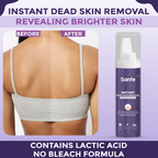 Sanfe Instant Dead Skin Removal Exfoliating Mousse | Grocsy