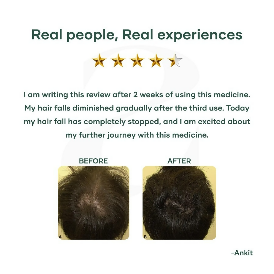 Mars By GHC Hair Regrowth Tablets | Grocsy