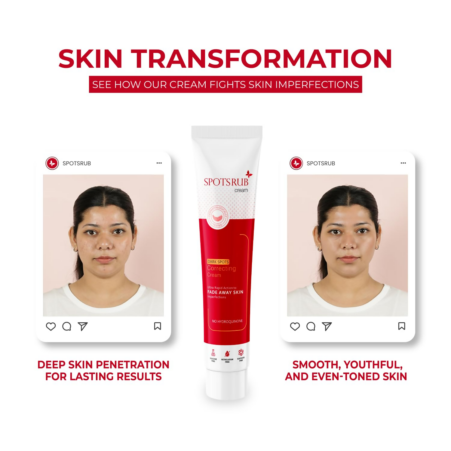 Leeford Spotsrub Face Cream For Women | Grocsy