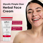 Globus Naturals Glycolic & 1% Salicylic Acid Herbal Anti Acne Face Cream | Grocsy