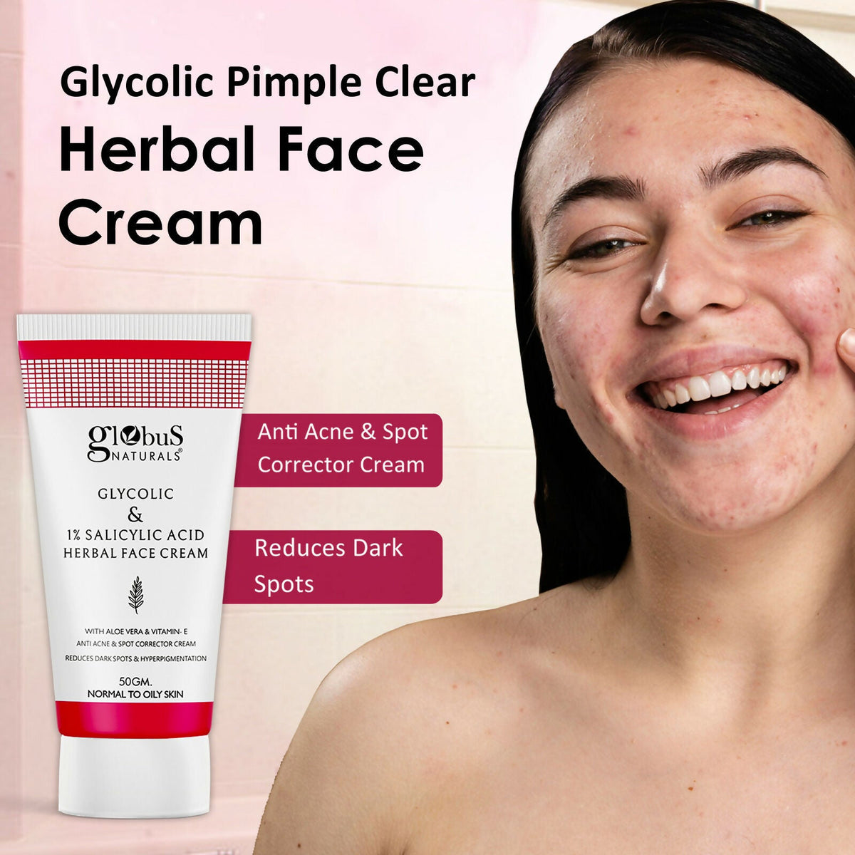 Globus Naturals Glycolic & 1% Salicylic Acid Herbal Anti Acne Face Cream | Grocsy