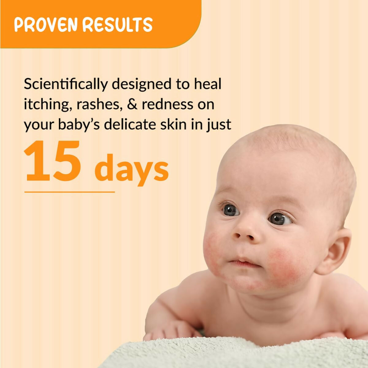 Fixderma Hoopoe Baby Anti-Itch Lotion - Soothing Relief for Itchy & Irritated Skin | Grocsy