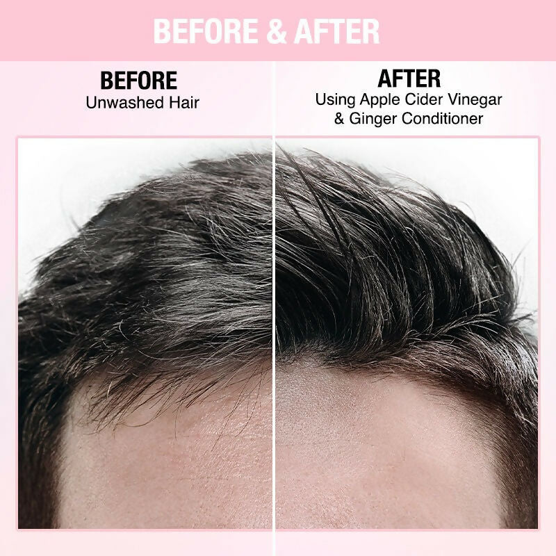 Nykaa Naturals Anti-Dandruff-Free Conditioner With Apple Cider Vinegar & Ginger | Grocsy