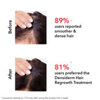 Professional O3+ Women Densiderm Anti Hair Loss Shampoo For Dense Hair & Regrowth | Grocsy